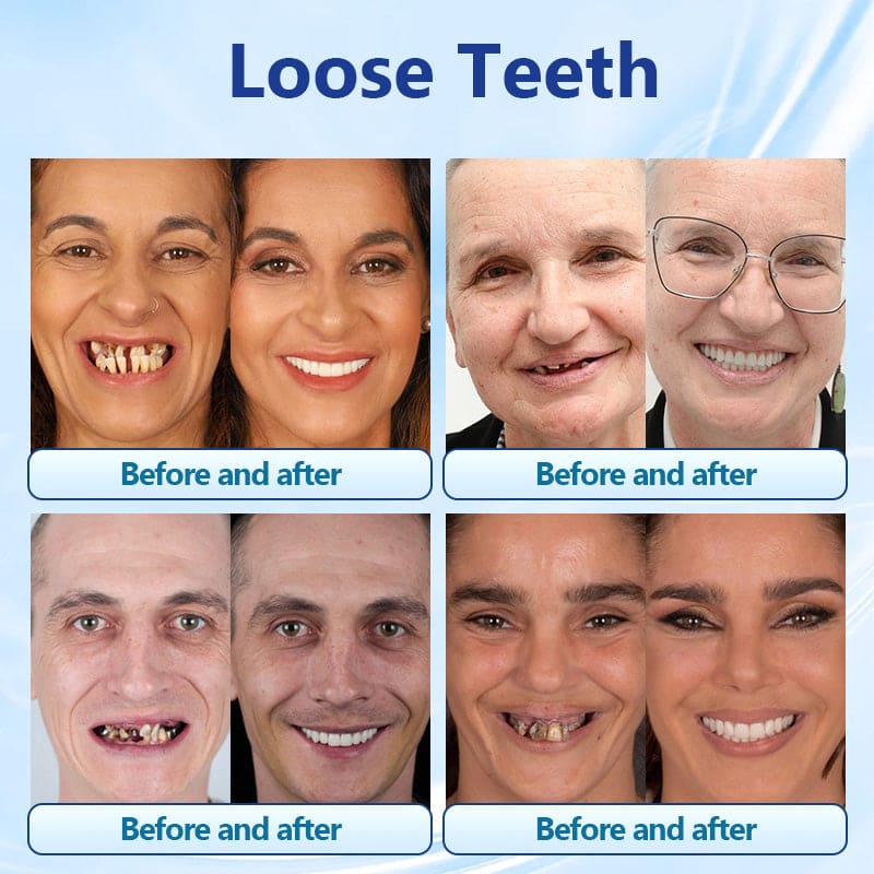 Silicone Denture Set 🦷