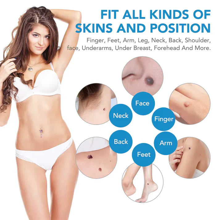 AutoSkin Tag Remover Kit - No More Skin Tags