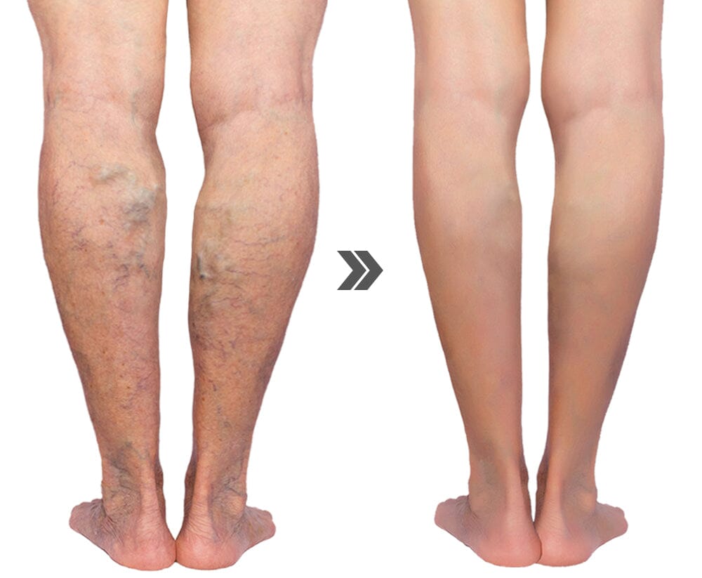 Biawily™ Cleansing Foot Pads